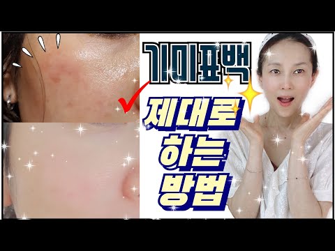 ✔ 도미나크림or멜라논크림 ❌이렇게하면 더 검어질 수 있어요!!