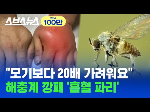 여름 벌레 끝판왕! 생살 찢어 피 빠는 한국 흡혈 파리 클라스 ;; / 스브스뉴스