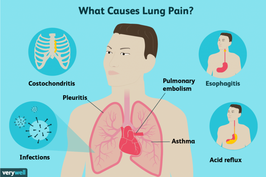 Lung Pain: Causes, Treatment, And When To See A Healthcare Provider