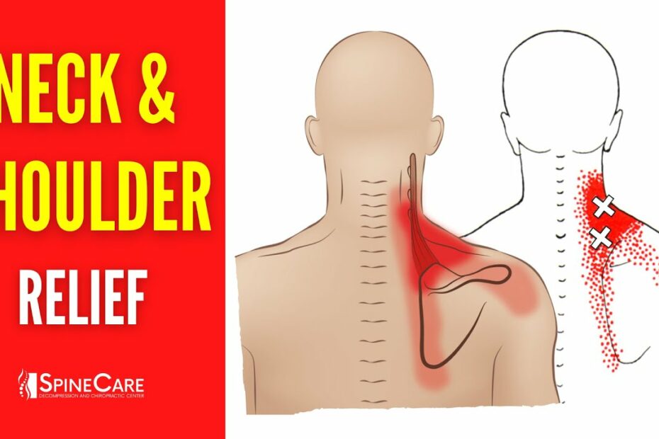 How To Fix Neck And Shoulder Pain For Good - Youtube