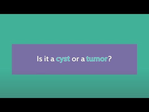 Is It a Tumor or Cyst? Differences Between Tumors & Cysts, & Cancer Concerns | SERO